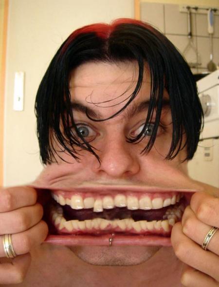 DENTITION